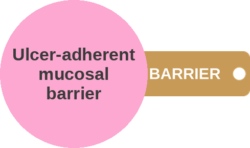 Ulcer-adherent mucosal barrier — mechanism peg (Ballicules)